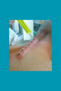 HYDROTOIME PER CUTANEE NADEGE NATUROPATHE